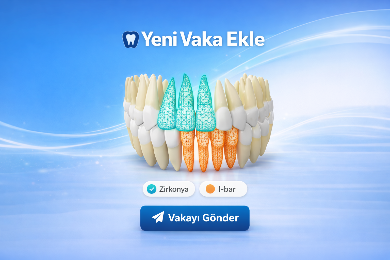 3D Vaka Oluşturma